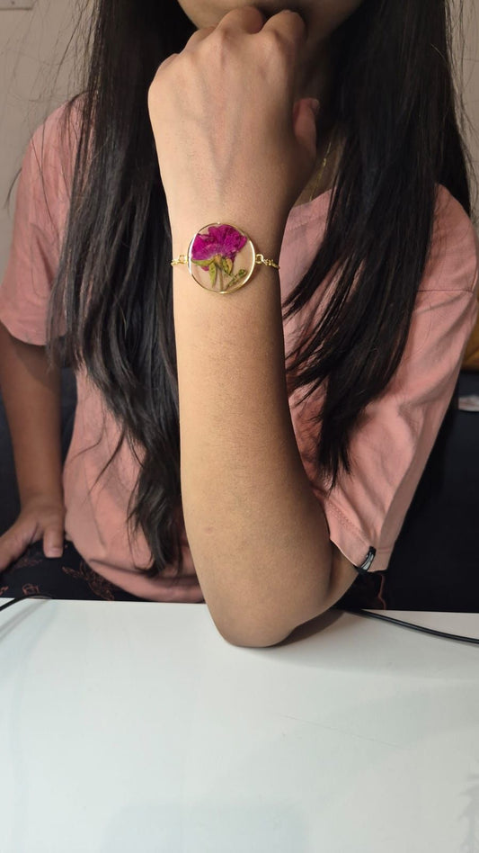 Rose Preservation in Bracelet